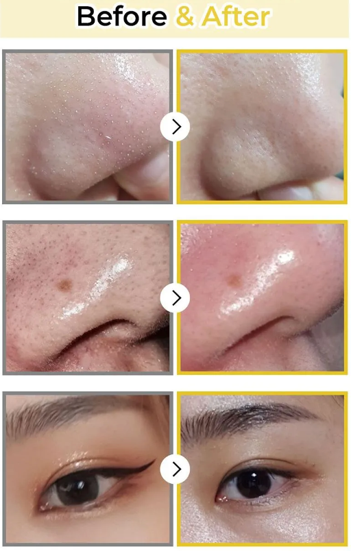 Huile démaquillante Easy Peasy