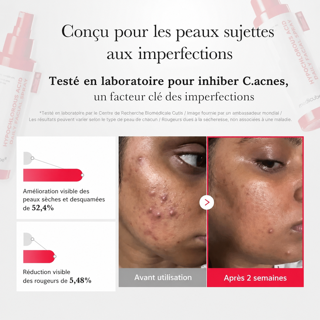 Spray anti-imperfections à l’acide hypochloreux