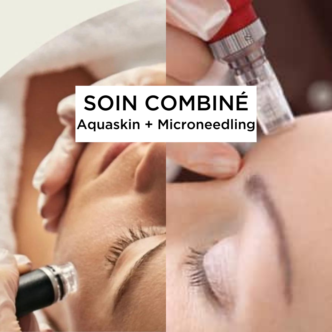 Soin combiné Aquaskin et Microneedling 160€