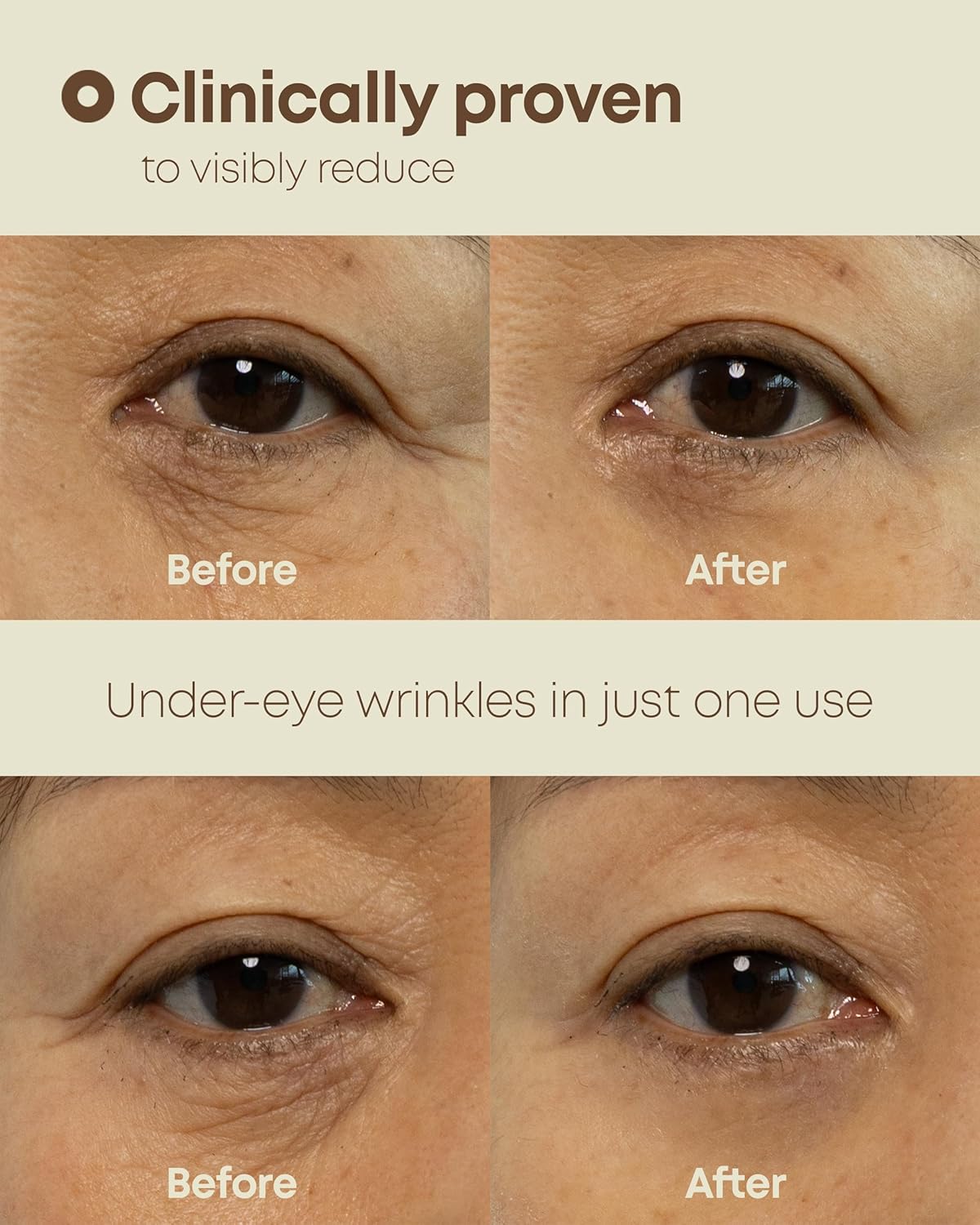 Contour des Yeux Ever-Youth