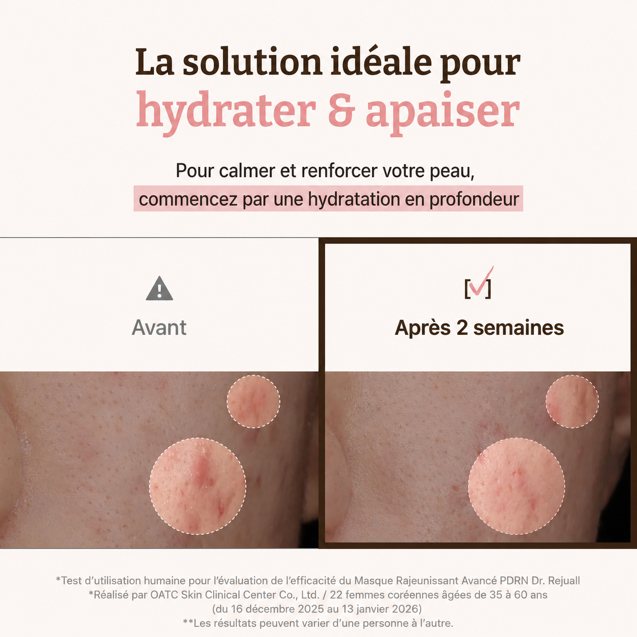 4 Masques PDRN Régénérant