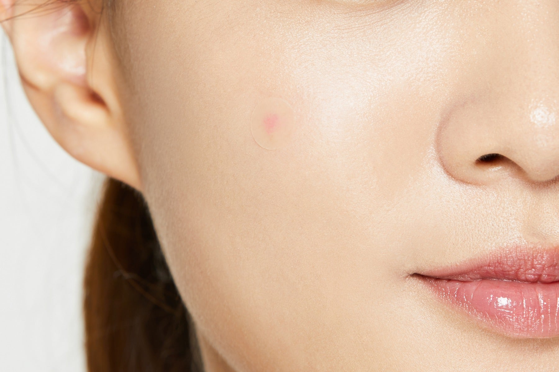 24 Patchs Correcteurs - Boutons Acné